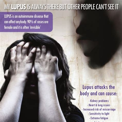 Lupus Awareness Poster Square Arthritis And Musculoskeletal Alliance