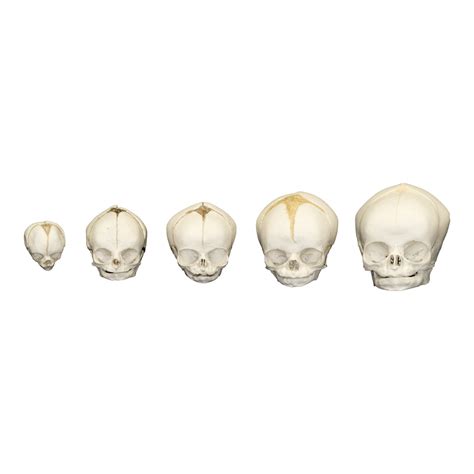 Replica Human Fetal Skulls Set Of 5 — Skulls Unlimited International