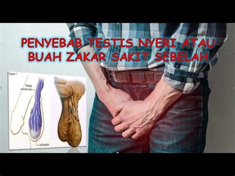 PENYEBAB TESTIS NYERI ATAU BUAH ZAKAR SAKIT SEBELAH YouTube