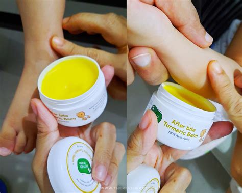 Mother Sparsh After Bite Turmeric Balm Review
