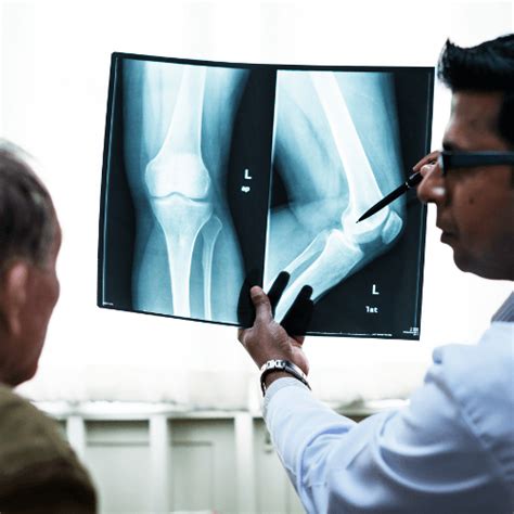 How to Live a Relatively Pain-Free Life with Arthritis - Welwitschia