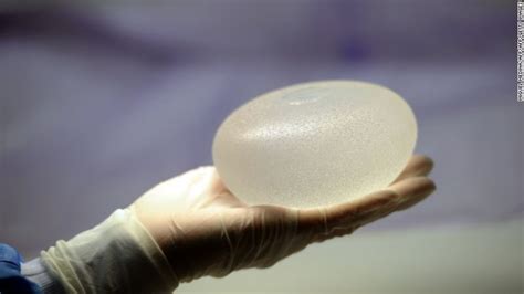 9 Deaths And Rare Cancer Linked To Breast Implants Fda Says