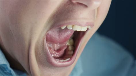 Angry Young Man Screaming Opening His Mouth Close Up Stock Video