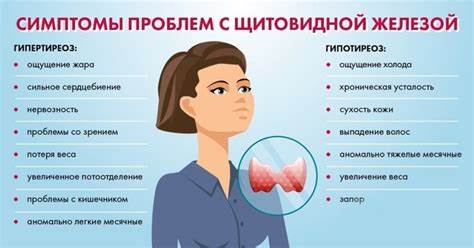 При щитовидке можно ли похудеть