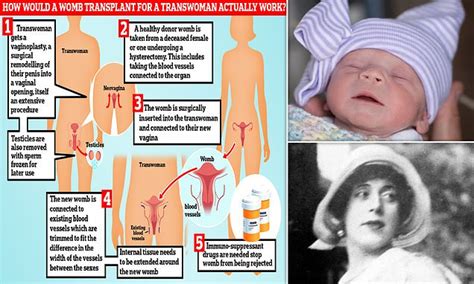 How Would A Womb Transplant Work For A Trans Women Who Were Born Men