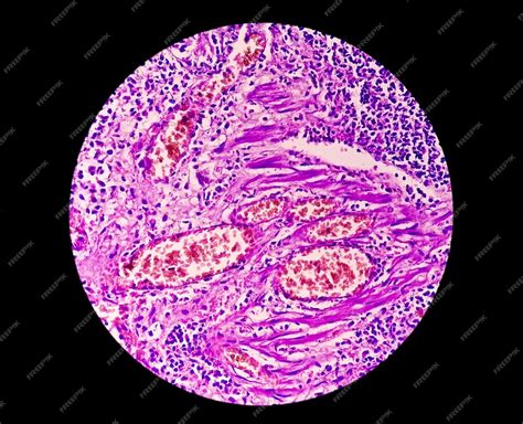 Premium Photo Microscopic Image Of A Cross Section Of An Appendix In
