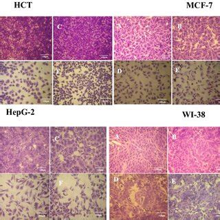 Morphological Characteristics Of HCT MCF 7 HepG 2 And WI 38 Cell