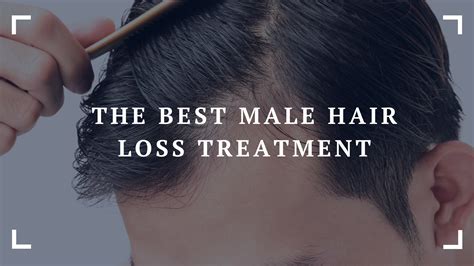 The Best Male Hair Loss Treatment In Nutri Inspector