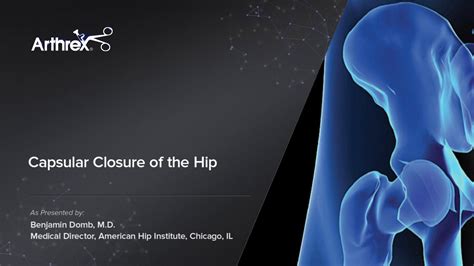 Arthrex Capsular Closure Of The Hip Surgical Technique