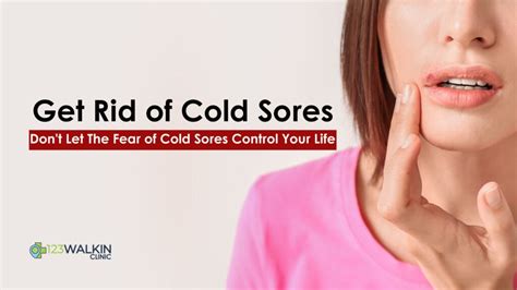 How To Get Rid Of Cold Sores Effective Home Remedies And Medical