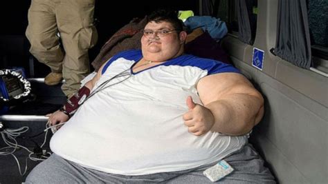 el hombre más obeso del mundo será operado en méxico tras perder 175 kilos