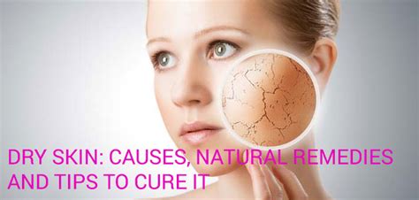 Dry Skin Causes Natural Remedies And Tips To Cure It