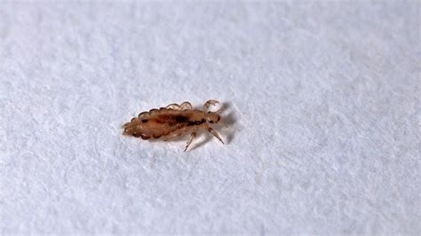What Does Lice Look Like Todays Parent