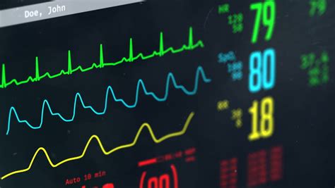 Monitoring Of Patients Condition Vital Signs On Icu Monitor In