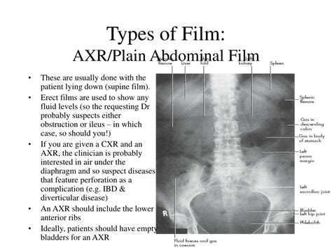Ppt Abdominal X Rays Tutorial Powerpoint Presentation Free Download