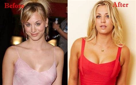 Kaley Cuoco Plastic Surgery Before And After Kaley Cuoco Kayley