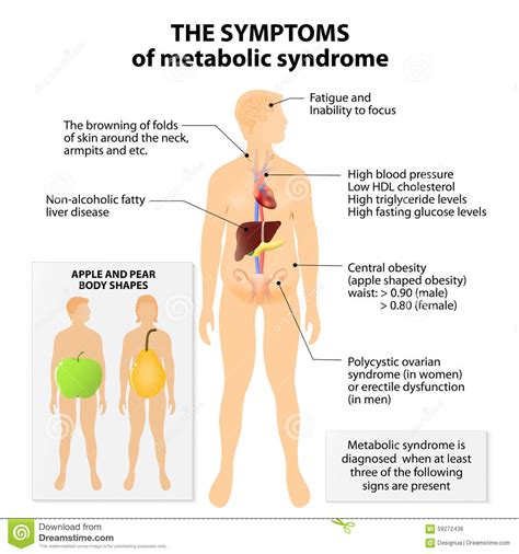 Metabolic Syndrome Stock Vector Illustration Of Medical