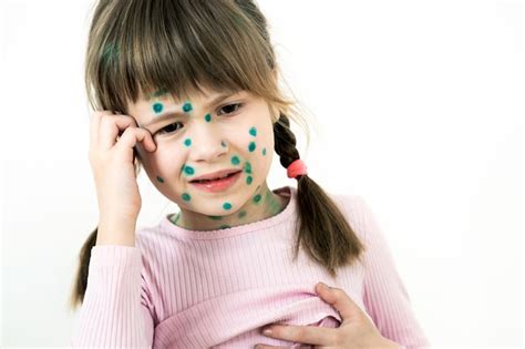 Enfant Fille Couverte Déruptions Cutanées Vertes Sur Le Visage Malade