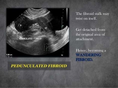 Basic Gynae Ultrasound