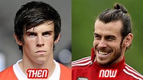 Gareth Bale Transformation Then And Now (Face & Body & Moth & Chin ...