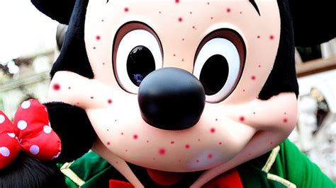 Mickey Mouse Still Stricken With Measles Thanks To The Anti Vaxxers