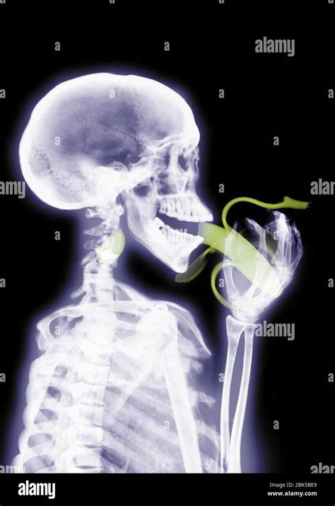 skelett röntgen röntgen essen fotos und bildmaterial in hoher auflösung alamy