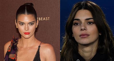 Before And After Kendall Jenners Face Transformation Who Magazine