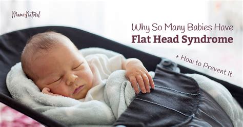 Plagiocephaly Aka Flat Head Syndrome What You Need To Know