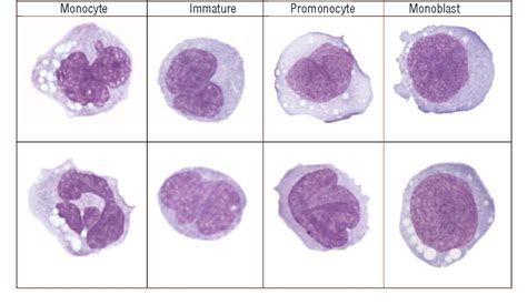 Figure 1 From Morphological Evaluation Of Monocytes And Their