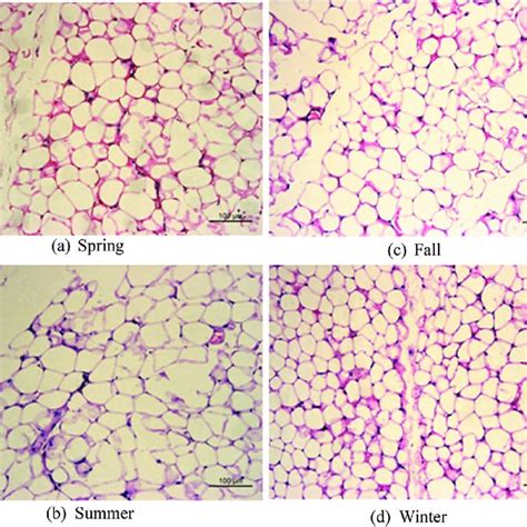 Morphological Study Of Seasonal Variation In Brown Adipose Tissue In