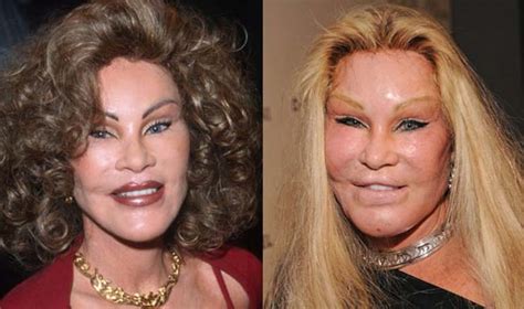 The Worst Celebrity Plastic Surgery Disasters Its Viral