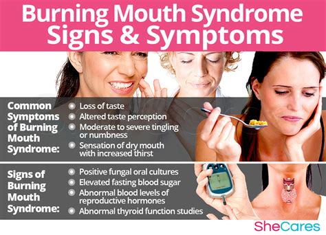 Burnical Burning Mouth Syndrome Symptoms Causes And T