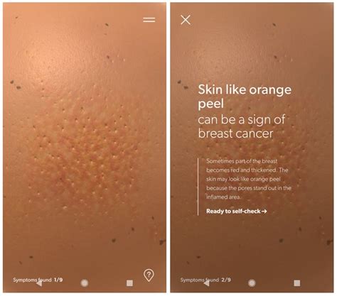 Breast Cancer Foundation Pre Check App To Look For Breast Cancer