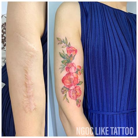 Scar Defying Art 92 Unique Tattoo Concepts For Skin Transformation