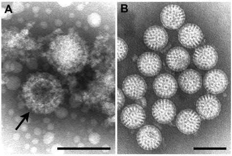 Viruses Special Issue Electron Microscopy In Virus Diagnostics And