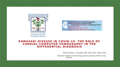 Pdf Kawasaki Disease In Covid 19 The Role Of Cardiac Computed