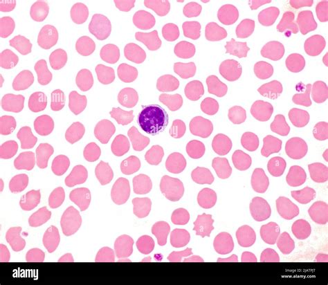 Human Blood Smear With Lymphocyte Light Micrograph Stock Photo Alamy