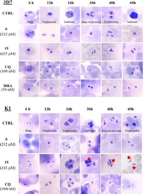 Morphology Of Plasmodium Falciparum After Compound Exposure 6 Two