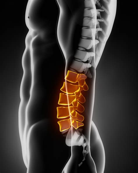 Low Back Pain Michigan Spine And Pain