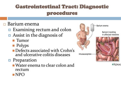 Ppt Gastrointestinal Disorder Powerpoint Presentation Free Download