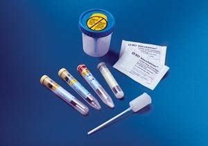 Bd Vacutainer Urine Collection System Cs Professional Medical
