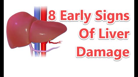 8 Early Signs Of Liver Damage That Everyone Should Know About Youtube