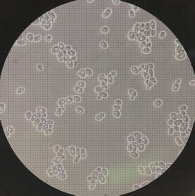 Los Mejores Microscopios De Contrastes De Fases Caracteristicas