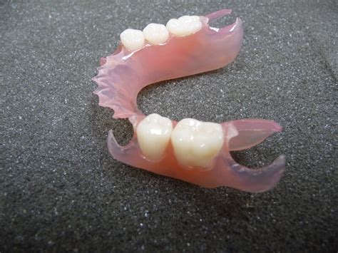 Flexible Partials Creech Dental Dr Cynthia B Creech Dds