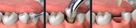 Oral Surgery Dbdent Clinic