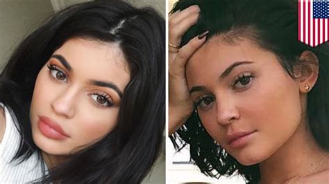 kylie jenner had her lip fillers removed — here s how tomonews youtube