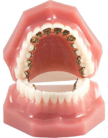 Orthodontist Missouri City Brilliant Smiles Orthodontics