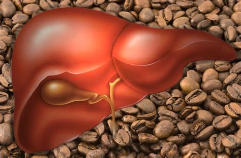 Coffee Slows Progression Of Liver Disease Livers With Life