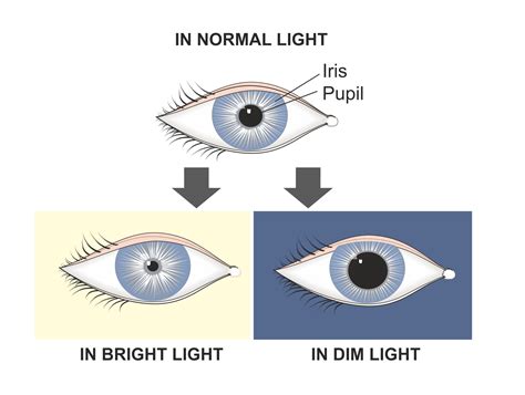 What To Expect When You Have Your Pupils Dilated Eye Consultants Of Fargo