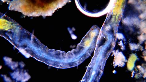 Amazing Microscopic Worm The Blue Tornado Microscopic Creative